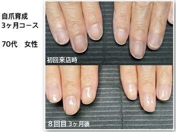 【自爪育成】育成コース3ヶ月後