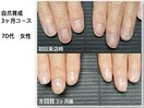 【自爪育成】育成コース3ヶ月後