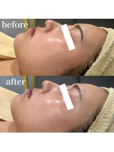 ジョアアンジェ 京橋店(joie ange)/ララピール1回