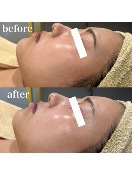 ジョアアンジェ 京橋店(joie ange)/ララピール1回