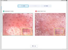 ベベ もりの里店(Be'be')