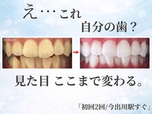 ホワイトニングショップ 今出川店(WHITENING SHOP)
