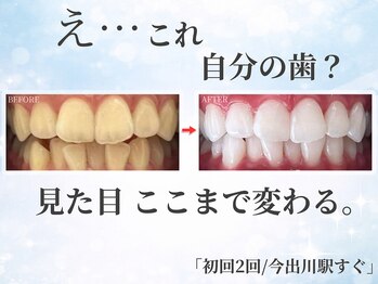 ホワイトニングショップ 今出川店(WHITENING SHOP)