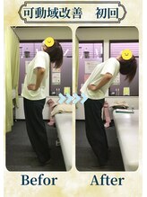 アミーゴ整体院/ビフォーアフター