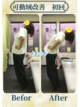 アミーゴ整体院/ビフォーアフター