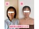 ママリラ(Mamarela)の写真/【土台から整う小顔】施術後すぐ実感◎蝶形骨からアプローチでその場しのぎでない小顔を目指しましょう！