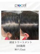 ユミト(Umit)/プロセルスカルプ