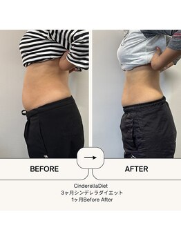 オーシャン整骨院(OCEAN整骨院)/６ヶ月コース