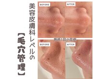 シルク(Silk)の雰囲気（丁寧なカウンセリング～施術♪１回目から感動の結果をご提供♪）