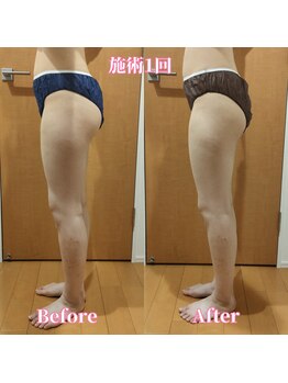 ヨサパーク サーナ 仙川(YOSA PARK Sana)/20代お客様ビフォー⇒アフター