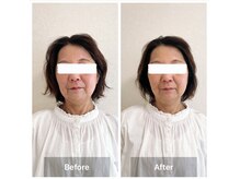 ラニ(Lani)/小顔美人整顔