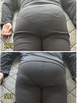 ヨサパーク ラリマー(YOSA PARK Larimar)/ビフォーアフター40代