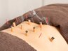 ＼おススメ／【鍼灸の力で全身リフレッシュ♪♪】　鍼灸施術60分　