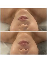 ゆずのはな/顎の位置に注目