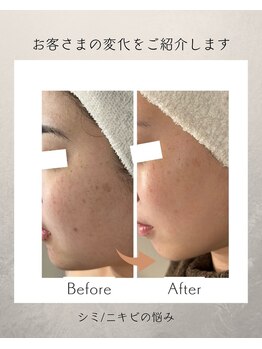 コーヴォ(COVO)/【ホワイトスノーピール】