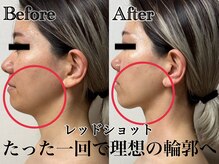 アンドエス 六本木(and S.)/韓国発！最新レッドショット☆