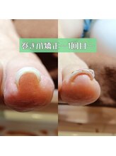 マニエネイル(mani e nail)/巻き爪ケア×美フォルムジェル