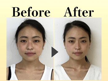 スマイル 神戸魚崎店(SMILE)/~Before、After~