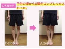 アイキ(aiki)/O脚・X脚改善
