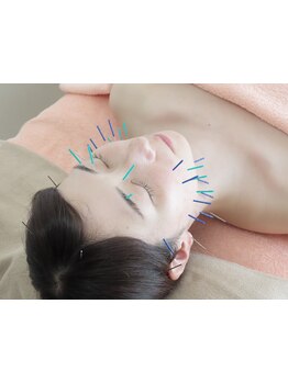 鍼灸施術を受けたい