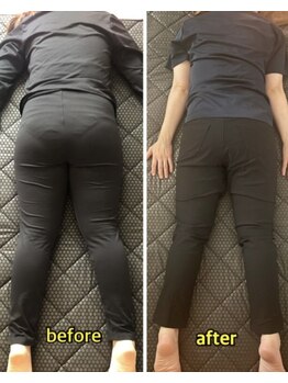 ヨサパーク ラリマー(YOSA PARK Larimar)/ビフォーアフター20代