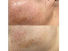 クラフト フェリーチェ 横芝店(CRAFT×felice)の雰囲気（ララピール　before→ａｆｔｅｒ写真トーンアップ）