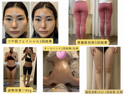フォルスボーテ(Force Beaute)の写真