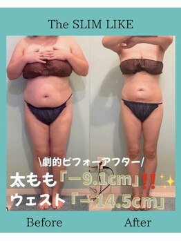スリムライク 鳥取店(The SLIM LIKE)/痩身ビフォーアフター