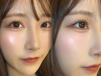 ポース(phoOs)/アンドヘルシー100本