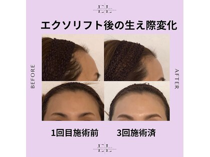 アルティ バイ ドルチェ(Ulti by dolce)の写真