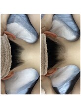 ［脱毛専門・肌育サロン］LULU.tokyo池袋2nd店/うなじ脱毛