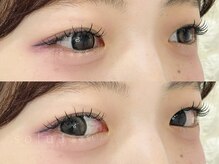 ソルア 上本町(solua)/フラットラッシュ80本