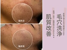 サンラックスサロン 岐阜(SANlux Salon)