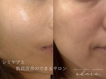 シェア(share.)の写真