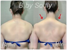 ビードット バイ ソーフライ(B.by So fly)/頑固な肩こりも解消！