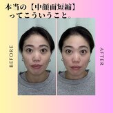 たいよう美容鍼灸院