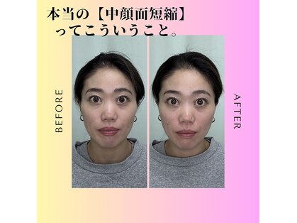 たいよう美容鍼灸院の写真