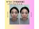 たいよう美容鍼灸院の写真