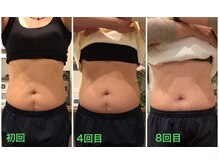 柏の葉オレンジ整体院/スマートスカルプトお腹スッキリ