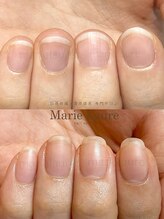 マリーロール 淀屋橋本店(Marie Laure)/自爪育成/深爪矯正/ネイルケア
