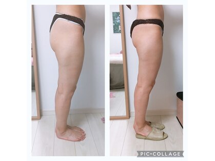 ビューティーチャージ(BeautyCharge)の写真