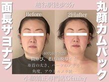 ジェイミー(Gemiey)/40代老け顔にお悩みのお客様