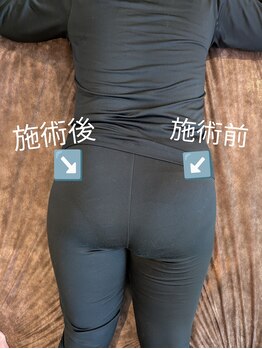 ヨサパーク アカーシャ(YOSA PARK AKASHA)/1回の施術での変化