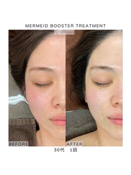 ジュブリエ(Jebrille)/マーメイドセルトリートメント