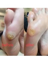 フットスタイル 八丁堀店(FOOT STYLE)/火曜日限定価格のフットケア！