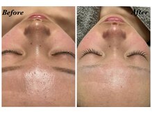 ルゼル(lezele)/クリスティーナアンストレス