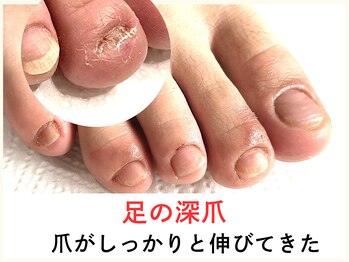 広島深爪専門ネイルサロン ナッカ/