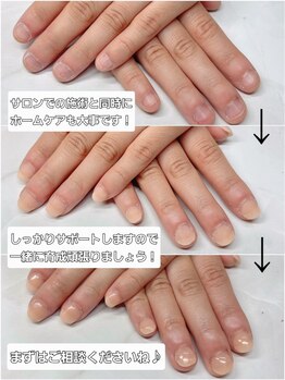 サロン ド コロレの写真/《メンズOK/バレない美爪》コンプレックスを魅力へチェンジ★速攻ケアでスラっと縦長フォルムを実現！