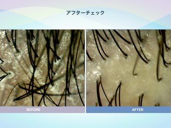 アンス(anth:)/お客様の仕上がり