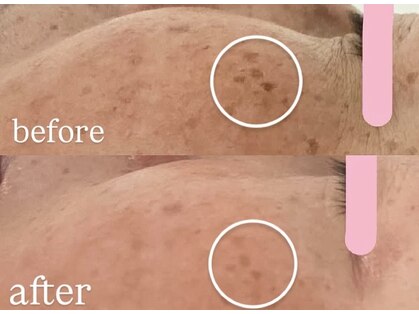 レアナチュラルケアサロン(Lea natural care salon)の写真